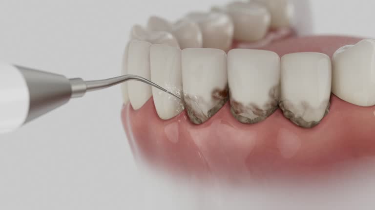 Reliable Dental contractor in Washington, IN by Dentist Open Now